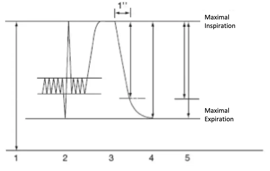 Volume-time curve. 1 = TLC, 2 = static vital capacity, 3 = FEV1 (forced expiratory volume in one second), 4 = FVC (forced vital capacity), 5 = Tiffeneau ratio = FEV1 / FVC.