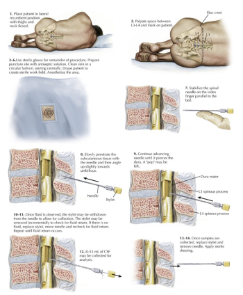 Lumbar puncture